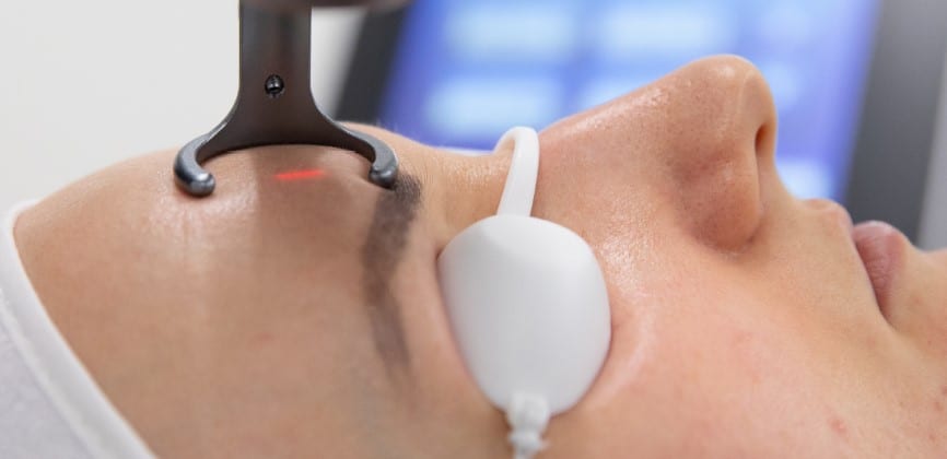Laser skin treatments Gloucester